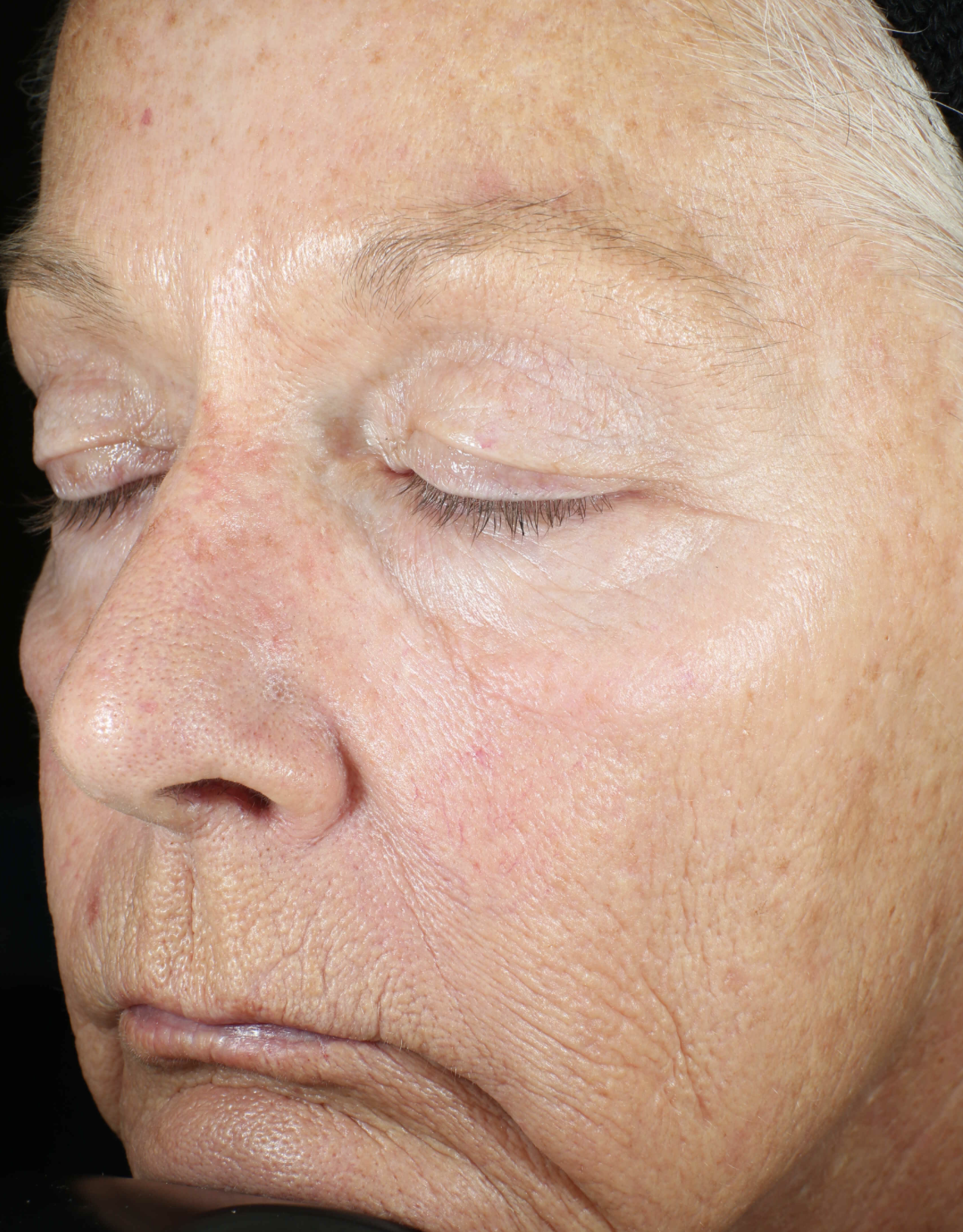 Wrinkle + Texture Repair - Image 4